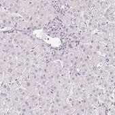 Anti-PLA2G4F antibody produced in rabbit Prestige Antibodies® Powered by Atlas Antibodies, affinity isolated antibody, buffered aqueous glycerol solution