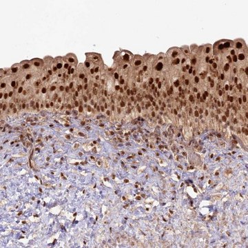 Anti-RRP8 antibody produced in rabbit Prestige Antibodies&#174; Powered by Atlas Antibodies, affinity isolated antibody, buffered aqueous glycerol solution