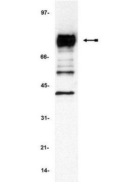 抗皮肌动蛋白（p80/85）抗体，克隆4F11 clone 4F11, Upstate&#174;, from mouse