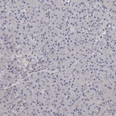 Anti-ALPK1 antibody produced in rabbit Prestige Antibodies® Powered by Atlas Antibodies, affinity isolated antibody, buffered aqueous glycerol solution, ab1
