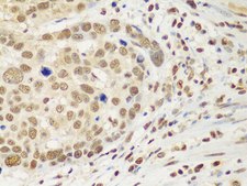 Anti-HDAC2 antibody produced in rabbit