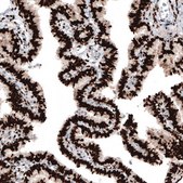 Monoclonal Anti-PGR antibody produced in mouse Prestige Antibodies® Powered by Atlas Antibodies, clone CL8721, purified immunoglobulin, buffered aqueous glycerol solution