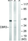 Anti-CBR3 antibody produced in rabbit affinity isolated antibody