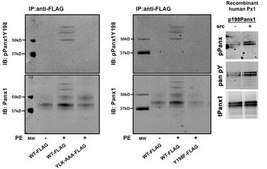 Anti-Phospho-PANX1 (Tyr198) from rabbit