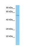 Anti-TRIM31 antibody produced in rabbit affinity isolated antibody