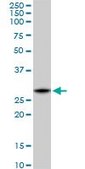 Monoclonal Anti-C1QTNF1 antibody produced in mouse clone 4A10, purified immunoglobulin, buffered aqueous solution