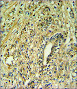 ANTI-HSD17B2 (CENTER) antibody produced in rabbit IgG fraction of antiserum, buffered aqueous solution