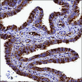 Anti-IL4I1 antibody produced in rabbit Prestige Antibodies® Powered by Atlas Antibodies, affinity isolated antibody, buffered aqueous glycerol solution