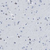 Anti-HLA-DPA1 antibody produced in rabbit Prestige Antibodies® Powered by Atlas Antibodies, affinity isolated antibody, buffered aqueous glycerol solution
