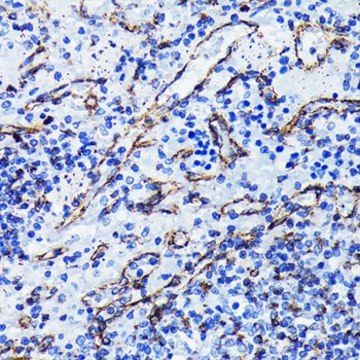 Anti- Vimentin antibody produced in rabbit