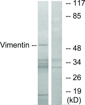 Anti-Vimentin antibody produced in rabbit affinity isolated antibody