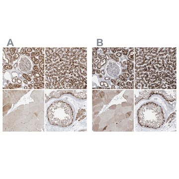 Anti-ABCD3 antibody produced in rabbit Prestige Antibodies&#174; Powered by Atlas Antibodies, affinity isolated antibody, buffered aqueous glycerol solution