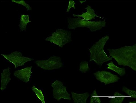 ANTI-DLX5 antibody produced in mouse clone 4C6, purified immunoglobulin, buffered aqueous solution