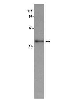 Anti-CUGBP1 Antibody, clone 3B1 clone 3B1, Upstate&#174;, from mouse