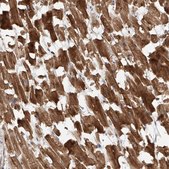 Anti-STX19 antibody produced in rabbit Prestige Antibodies® Powered by Atlas Antibodies, affinity isolated antibody, buffered aqueous glycerol solution