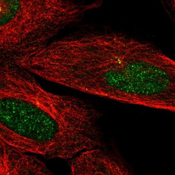 Anti-CAMK2N2 antibody produced in rabbit Prestige Antibodies&#174; Powered by Atlas Antibodies, affinity isolated antibody