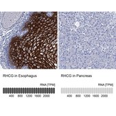 Anti-RHCG antibody produced in rabbit Prestige Antibodies® Powered by Atlas Antibodies, affinity isolated antibody, buffered aqueous glycerol solution