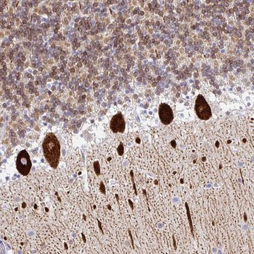 抗-TP53I11 兔抗 Prestige Antibodies&#174; Powered by Atlas Antibodies, affinity isolated antibody, buffered aqueous glycerol solution