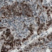 Monoclonal Anti-KDM5B antibody produced in mouse Prestige Antibodies® Powered by Atlas Antibodies, clone CL1129, purified immunoglobulin, buffered aqueous glycerol solution
