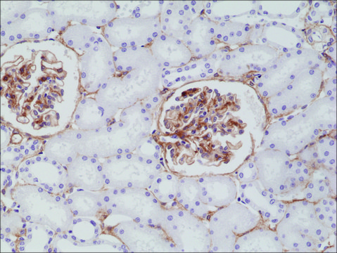 Anti-CD140b (PDGF Receptor beta)antibody, Rabbit Monoclonal recombinant, expressed in HEK 293 cells, clone RM303, purified immunoglobulin