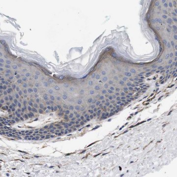 Anti-WNT10A antibody produced in rabbit Prestige Antibodies&#174; Powered by Atlas Antibodies, affinity isolated antibody, buffered aqueous glycerol solution