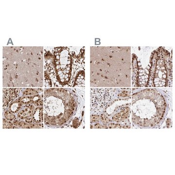 Anti-GLYR1 antibody produced in rabbit Prestige Antibodies&#174; Powered by Atlas Antibodies, affinity isolated antibody, buffered aqueous glycerol solution