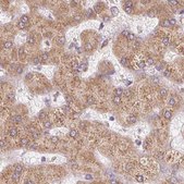Anti-RPN1 antibody produced in rabbit Prestige Antibodies® Powered by Atlas Antibodies, affinity isolated antibody