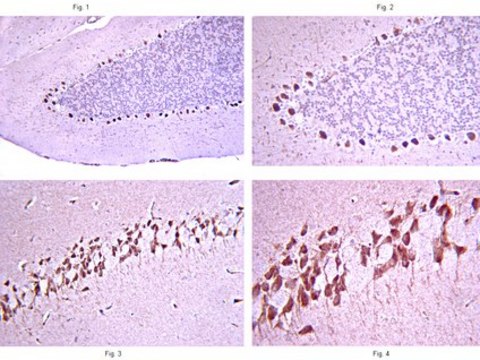 Anti-Zic2 Antibody from rabbit, purified by affinity chromatography