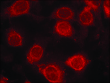 Anti-phospho-EIF4E (pSer209) antibody produced in rabbit affinity isolated antibody