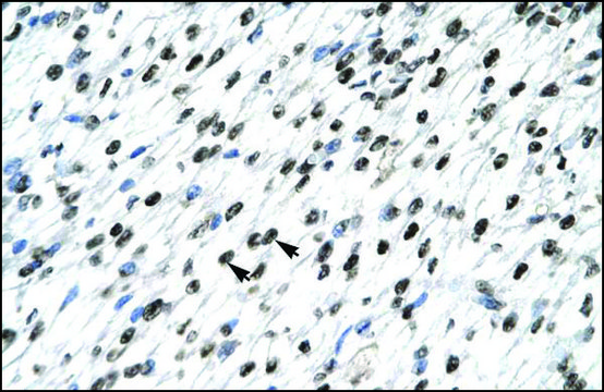 Anti-HOXB9 antibody produced in rabbit affinity isolated antibody