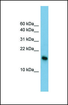 Anti-BATF3, (N-terminal) antibody produced in rabbit affinity isolated antibody