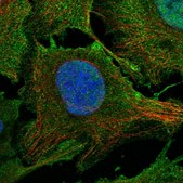 Anti-PHF20L1 antibody produced in rabbit Prestige Antibodies® Powered by Atlas Antibodies, affinity isolated antibody, buffered aqueous glycerol solution, ab2