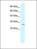 Anti-TBX20 (AB1) antibody produced in rabbit affinity isolated antibody
