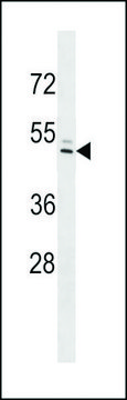 ANTI-IFI44L(C-TERMINAL) antibody produced in rabbit affinity isolated antibody, buffered aqueous solution