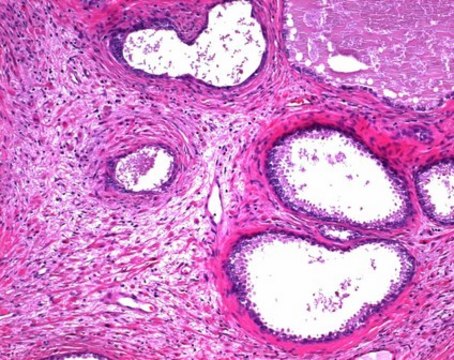 Eosin Y solution 1%, alcoholic for microscopy