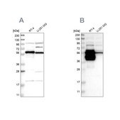 Anti-BAIAP2L1 antibody produced in rabbit Prestige Antibodies® Powered by Atlas Antibodies, affinity isolated antibody, buffered aqueous glycerol solution, Ab2