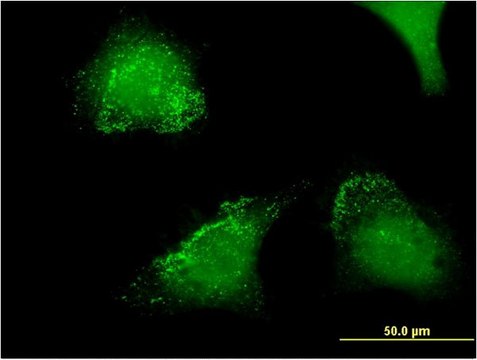 Monoclonal Anti-ACP5 antibody produced in mouse clone 2D9, purified immunoglobulin, buffered aqueous solution