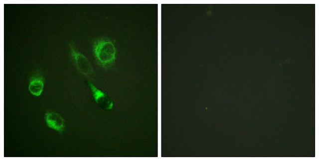 Anti-phospho-EPHA2/3/4 (pTyr588/596) antibody produced in rabbit affinity isolated antibody