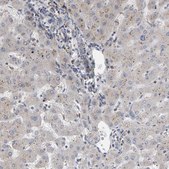 Anti-IPPK antibody produced in rabbit Prestige Antibodies® Powered by Atlas Antibodies, affinity isolated antibody, buffered aqueous glycerol solution