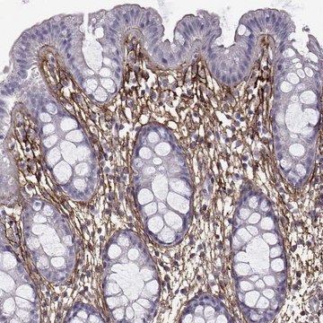 Anti-EMILIN2 antibody produced in rabbit Prestige Antibodies&#174; Powered by Atlas Antibodies, affinity isolated antibody