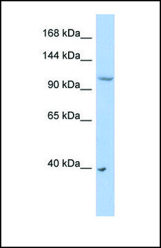 Anti-NEDD4L antibody produced in rabbit affinity isolated antibody