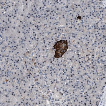 Anti-ZDHHC15 antibody produced in rabbit Prestige Antibodies&#174; Powered by Atlas Antibodies, affinity isolated antibody, buffered aqueous glycerol solution