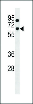 ANTI-SNRNP70 (CENTER) antibody produced in rabbit affinity isolated antibody, buffered aqueous solution