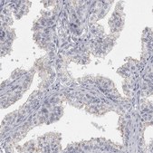 Anti-PLIN1 antibody produced in rabbit Prestige Antibodies® Powered by Atlas Antibodies, affinity isolated antibody, buffered aqueous glycerol solution