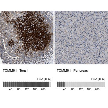 Anti-TOMM6 antibody produced in rabbit Prestige Antibodies&#174; Powered by Atlas Antibodies, affinity isolated antibody, buffered aqueous glycerol solution