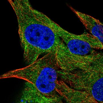 Anti-FAM134A antibody produced in rabbit Prestige Antibodies&#174; Powered by Atlas Antibodies, affinity isolated antibody