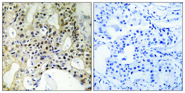 Anti-LATS1 antibody produced in rabbit affinity isolated antibody