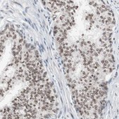 Anti-LIG3 antibody produced in rabbit Prestige Antibodies® Powered by Atlas Antibodies, affinity isolated antibody, buffered aqueous glycerol solution
