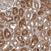 Anti-TRMT61B antibody produced in rabbit Prestige Antibodies® Powered by Atlas Antibodies, affinity isolated antibody, buffered aqueous glycerol solution, Ab1