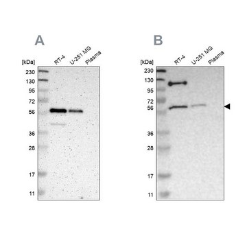 Anti-TRAF2 antibody produced in rabbit Ab1, Prestige Antibodies&#174; Powered by Atlas Antibodies, affinity isolated antibody, buffered aqueous glycerol solution